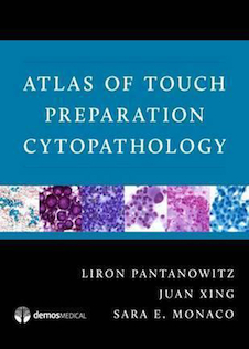 عکس Atlas of Touch Preparation Cytopathology20174  آماده سازی سیتوپاتیولوژی لمسی