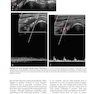 Fundamentals of Musculoskeletal Ultrasound 3rd Edition 2017