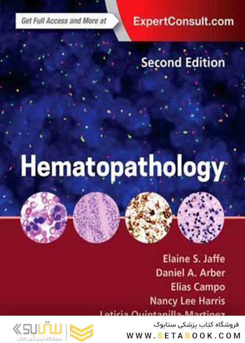 Hematopathology, 2nd Edition 2016