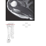 Pocket Atlas of Sectional Anatomy, Volume III, 2nd Edition 2017