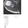 Pocket Atlas of Sectional Anatomy, Volume III, 2nd Edition 2017