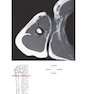 Pocket Atlas of Sectional Anatomy, Volume III, 2nd Edition 2017