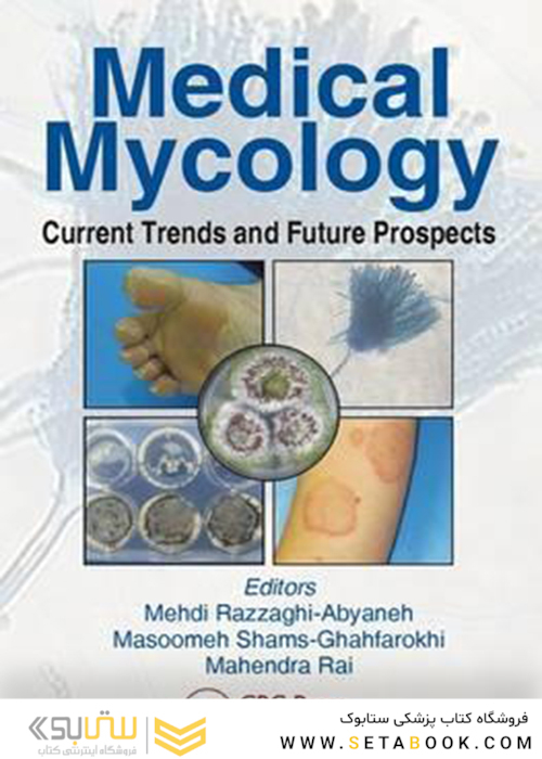 Medical Mycology: Current Trends and Future Prospects 1st Edition2015 قارچ شناسی پزشکی