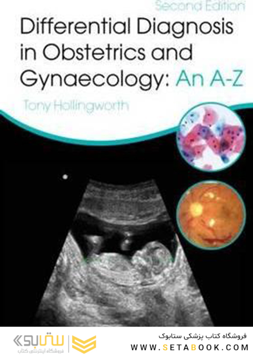 Differential Diagnosis in Obstetrics - Gynaecology: An A-Z, Second Edition2015 تشخیص افتراقی در زنان و زایمان