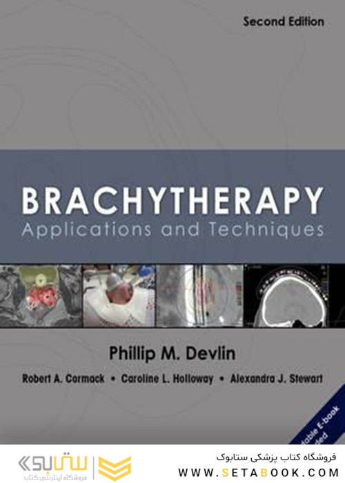 Brachytherapy, Second Edition: Applications and Techniques 2nd Edition2015 براکی تراپی