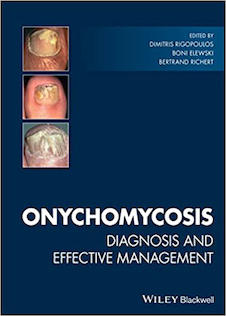 عکس Onychomycosis: Diagnosis and Effective Management 1st Edition2018