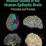 Invasive Studies of the Human Epileptic Brain2019 مطالعات تهاجمی مغز صرعی انسان