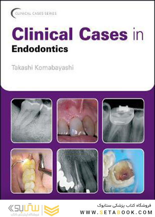 Clinical Cases in Endodontics, 1st Edition2018 موارد بالینی در اندودنتیکس