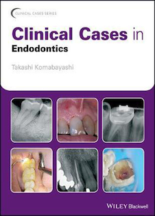 عکس Clinical Cases in Endodontics, 1st Edition2018 موارد بالینی در اندودنتیکس
