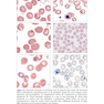 Wintrobe’s Atlas of Clinical Hematology, 2th Edition 2017