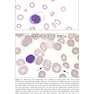Wintrobe’s Atlas of Clinical Hematology, 2th Edition 2017