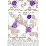 Wintrobe’s Atlas of Clinical Hematology, 2th Edition 2017