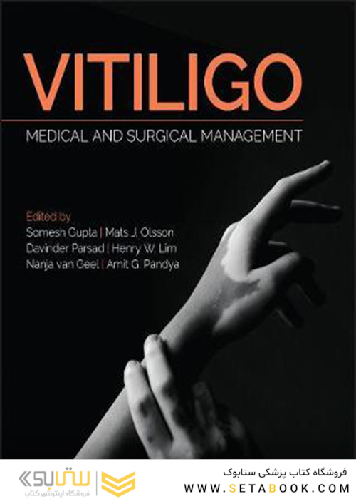 Vitiligo: Medical and Surgical Management 1st Edition2018 ویتیلیگو: مدیریت پزشکی و جراحی