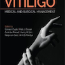 Vitiligo: Medical and Surgical Management 1st Edition2018 ویتیلیگو: مدیریت پزشکی و جراحی