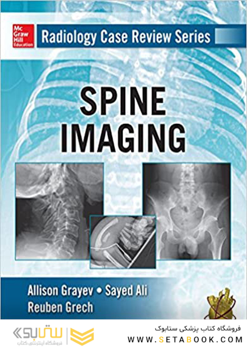 Radiology Case Review Series: Spine2015 مجموعه بررسی موارد رادیولوژی: ستون فقرات
