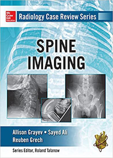 عکس Radiology Case Review Series: Spine2015 مجموعه بررسی موارد رادیولوژی: ستون فقرات