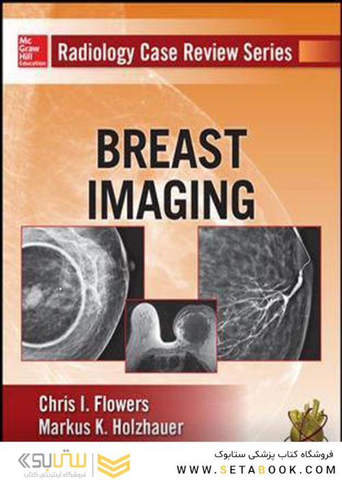 Radiology Case Review Series: Breast Imaging2014 مجموعه بررسی موارد رادیولوژی: تصویربرداری از پستان