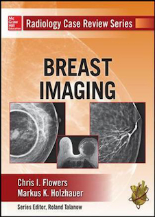 عکس Radiology Case Review Series: Breast Imaging2014 مجموعه بررسی موارد رادیولوژی: تصویربرداری از پستان