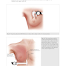 Breast Augmentation Video Atlas, 2nd Edition 2019