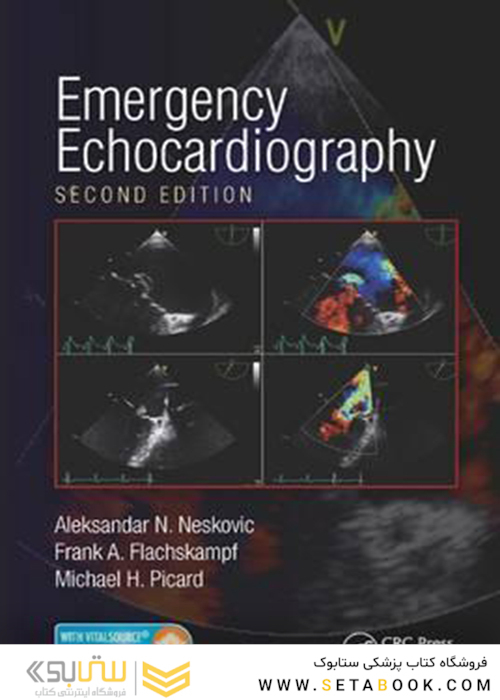 Emergency Echocardiography 2nd Edition2016