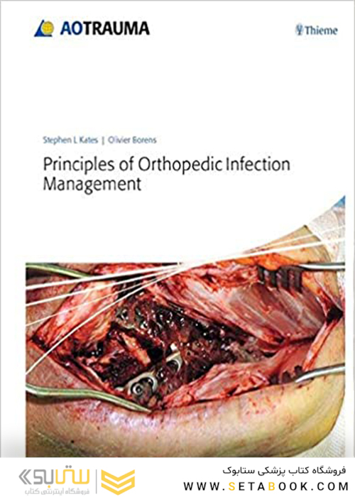 Principles of Orthopedic Infection Management2017