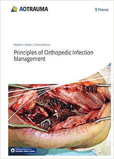 عکس Principles of Orthopedic Infection Management2017