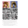 Principles of Orthopedic Infection Management2017