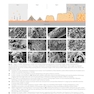 Principles of Orthopedic Infection Management2017
