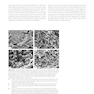 Principles of Orthopedic Infection Management2017