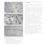 Principles of Orthopedic Infection Management2017