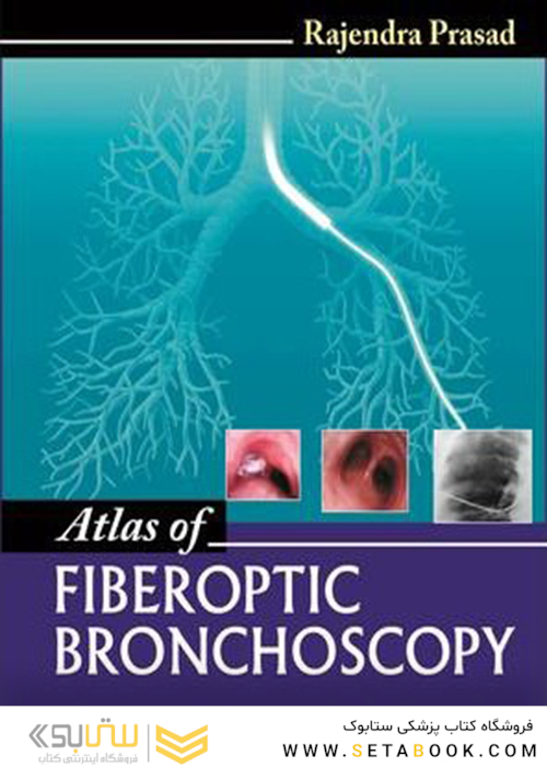 Atlas of Fiberoptic Bronchoscopy 1st Edition2013 اطلس فیبرنوپتیک برونکوسکوپی