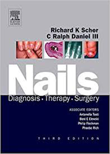 عکس Nails: Diagnosis, Therapy, Surgery 3rd Edition2005