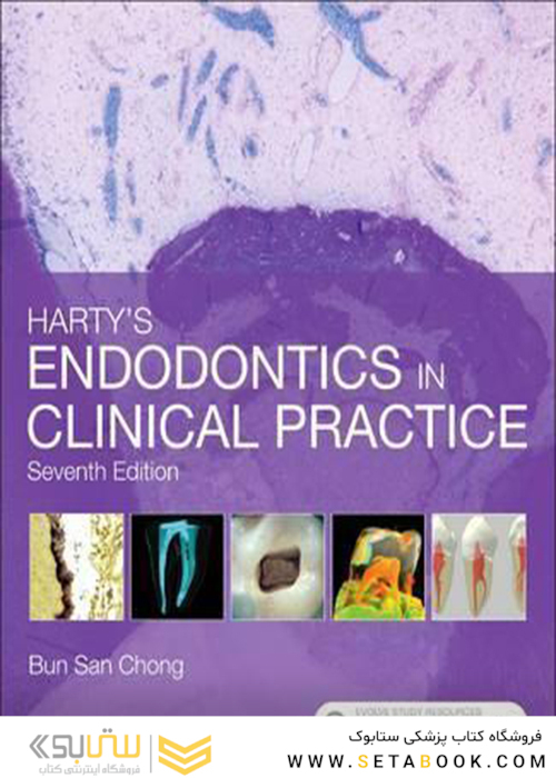Harty’s Endodontics in Clinical Practice 7th Edition2016 اندودنتیکس در عمل بالینی