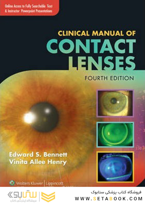 Clinical Manual of Contact Lenses, Fourth Edition2013 راهنمای بالینی لنزهای تماسی