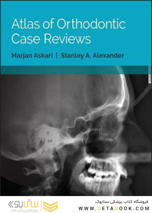 Atlas of Orthodontic Case Reviews, 1st Edition2017