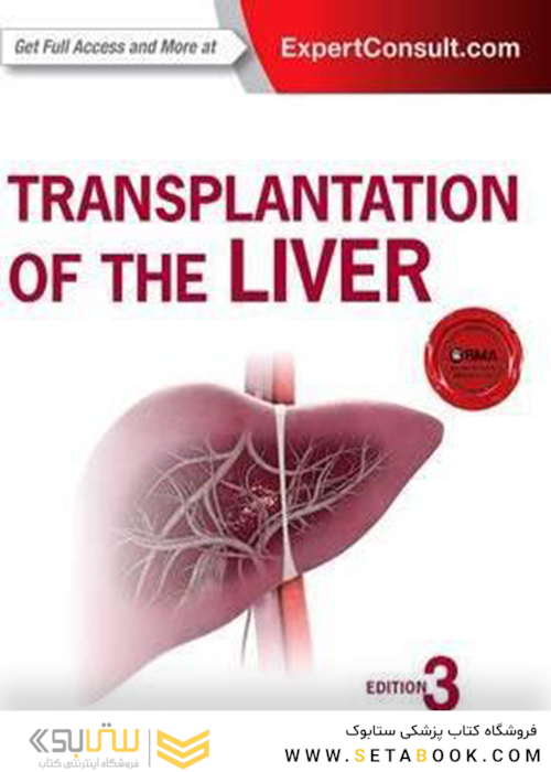 Transplantation of the Liver, 3rd Edition2015 پیوند کبد