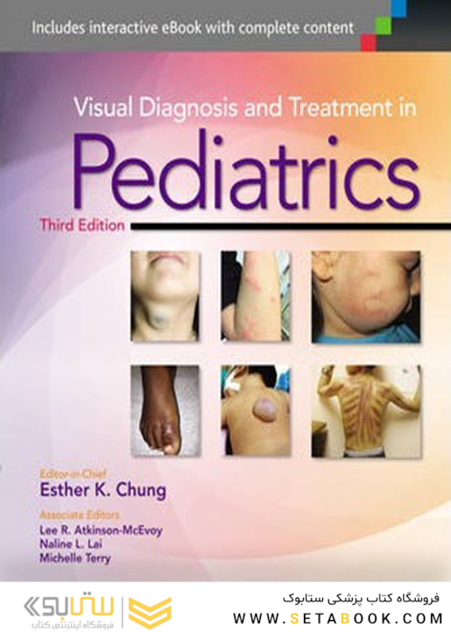 Visual Diagnosis and Treatment in Pediatrics, Third Edition2014 تشخیص و درمان بینایی در کودکان