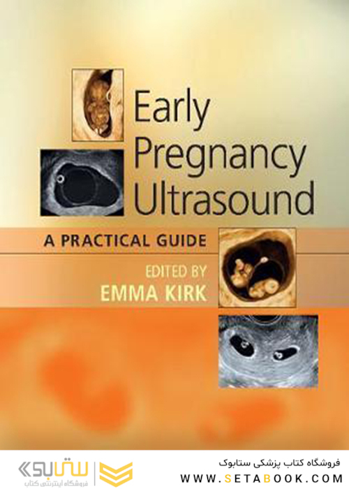 Early Pregnancy Ultrasound: A Practical Guide 1st Edition2017 سونوگرافی در اوایل بارداری