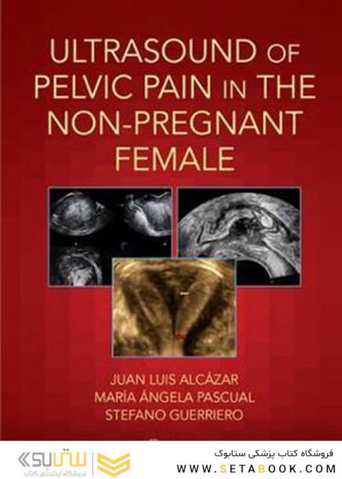 Ultrasound of Pelvic Pain in the Non-Pregnant Patient2019 سونوگرافی درد لگن در بیمار غیر باردار