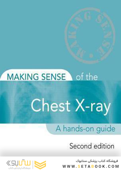 Making Sense of the Chest X-ray: A hands-on guide, 2nd Edition2013 ساختن حس اشعه ایکس قفسه سینه: یک راهنمای عملی
