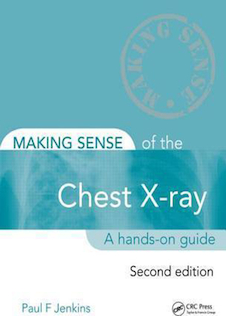 عکس Making Sense of the Chest X-ray: A hands-on guide, 2nd Edition2013 ساختن حس اشعه ایکس قفسه سینه: یک راهنمای عملی