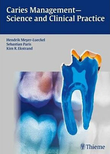 عکس Caries Management – Science and Clinical Practice 1st Edition2020 مدیریت پوسیدگی - علم و عمل بالینی