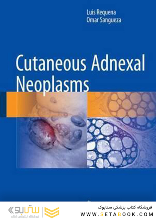 Cutaneous Adnexal Neoplasms, 1st Edition2018 نئوپلاسم های پوستی