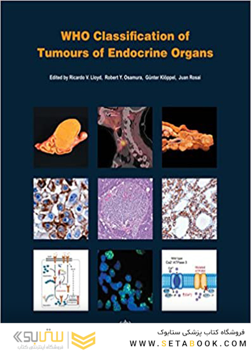 WHO Classification of Tumours of Endocrine Organs, 4th Edition2017 طبقه بندی تومورهای اندام های غدد درون ریز