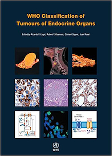 عکس WHO Classification of Tumours of Endocrine Organs, 4th Edition2017 طبقه بندی تومورهای اندام های غدد درون ریز