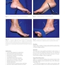 Foot and Ankle Sports Orthopaedics, 1st Edition2017