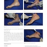 Foot and Ankle Sports Orthopaedics, 1st Edition2017