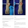 Foot and Ankle Sports Orthopaedics, 1st Edition2017