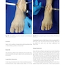 Foot and Ankle Sports Orthopaedics, 1st Edition2017