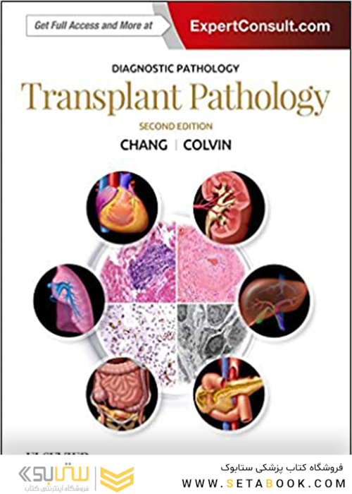 Diagnostic Pathology: Transplant Pathology, 2nd Edition 2018